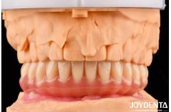 China Natural Looking Acrylic Denture Finish High Biocompatibility With Tooth Arrangement Technology supplier