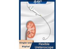 China Ultra-Slim Disposable Flexible Ureteroscope supplier