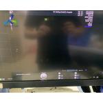 GE Voluson E10 Ultrasound Machine Repair All Probes Without Echo Repair RFM423 for sale