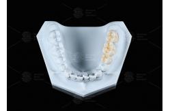 China Translucency White Full Contour Zirconia Crown FCZ Monolithic Zirconia Crown Easy Milling supplier