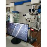 Double Binocular Ophthalmic Surgery Microscope With CCD Camera for sale