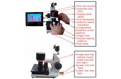 China LCD Display Colour Microcirculation Test Machine Clinical Hospital Home supplier