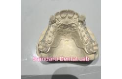 China Removable Cast Clear Framework Partial Easy To Clean And Take Off supplier