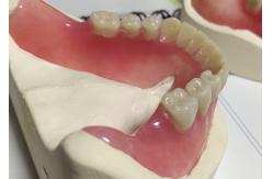 China Esthetics Full Denture Cold Cured Acrylic Partial Denture supplier