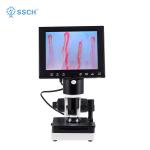 Portable Nailfold Capillary Diagnosis Microcirculation Microscope Blood Circulation for sale
