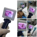 Operating Portable Video Laryngoscope Using In Routine Endotracheal Intubation for sale