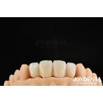 Biologically Oriented Preparation Technique BOPT For Accurate Dental Preparation for sale