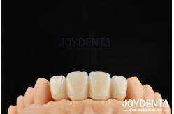China Biologically Oriented Preparation Technique BOPT For Accurate Dental Preparation supplier