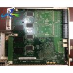 ATL CX50 Ebox Ultrasonic Board 453561769362 For Clinic for sale