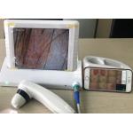 Digital Handheld Video Dermatoscope with 8 Inch Screen 1,4,9 Pictures Displaying for sale