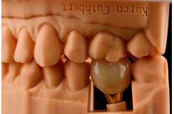 China 10mm Titanium Tooth Implant Sandblasted Self Tapping Dental Implants supplier