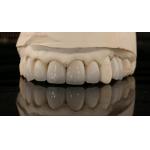 China Dental Lab Zirconia Full Contour Crown High Aesthetic Natural Dental Bridge 5 Year Guarantee for sale