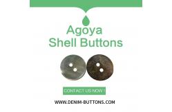 China Agoya Shell Buttons | Bulk Clothing Button supplier