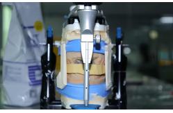 China Dental PFM Crown manufacturer