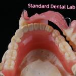 Removable Dental Restorations Acrylic Partial Denture Teeth With Wire Clasps for sale