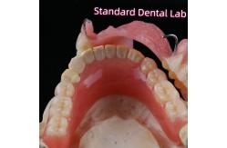 China Removable Dental Restorations Acrylic Partial Denture Teeth With Wire Clasps supplier