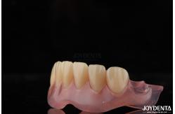 China Personalized Invisible Denture Finished With Advanced Tooth Arrangement Technology supplier