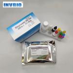 Tumor Markers CEA Cancer Elisa Assay Kit CA15-3 Antigen for sale