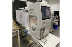 China Peripheral Vision Perimetry Test Machine Yellow 315 Asb Comprehensive Analysis Software supplier