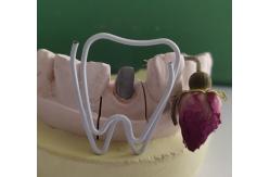 China Metal Dental Post And Core After Endodontic Treatment supplier