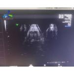 GE Voluson E8 Ultrasound Machine Repair Abnormal Ultrasound Images Replace Rfm Board for sale