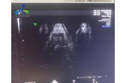 China GE Voluson E8 Ultrasound Machine Repair Abnormal Ultrasound Images Replace Rfm Board supplier