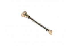 China Titanium Fibular Intramedullary Interlocking Nail 4.0 4.5 supplier