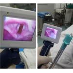 Portable video laryngoscope with 3pcs reusable blade