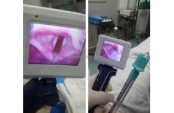 China Portable video laryngoscope with 3pcs reusable blade supplier