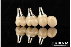China Ultra-precision processing Zirconia Implants All-Zirconium Integrated Crown supplier