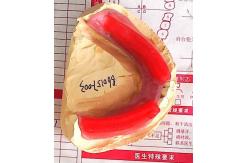 China Biteblocks For Jaw Relation Before Complete Denture supplier