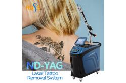 China Nd Yag Q Switched Laser Machine For Skin Rejuvenation 1064nm supplier