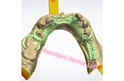 China Metal Framework Design Laser Printing Cast Chrome Partial Denture Ni Be Free supplier