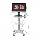 FHD All In One Endoscope Camera System Built-in LED Light & Flexible Scope For Laparoscopy for sale