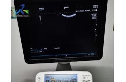 China All Probe Images No Echo Ultrasound machine Repair System Aloka ARIETTA 70 supplier