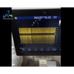 GE Vivid S6 Ultrasound Machine Repair Interference In CW Mode Replace PIB Board for sale