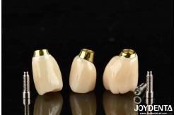 China High Durability White Finish Implant Crown And Bridge With Accurate Fit supplier