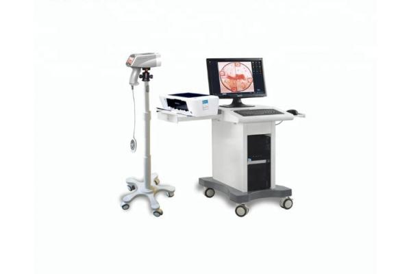 Digital Video Colposcope