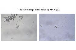 China SpermFunc Male Fertility Test Kit For Determination IgG Antibody Coating Spermatozoa supplier