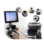 600cd/m2 Microcirculation Microscope Nailfold Capillary Test Connected To Laptop