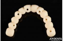 China Customizable Ti-Base Zirconia Hybrid Bridge With Excellent Durability And Good Biocompatibility supplier