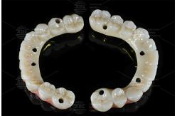 China Professional Dental Lab Outsourcing Services Delivering Accurate Dental Prosthetics and Custom Solutions for Dental Industry Needs supplier