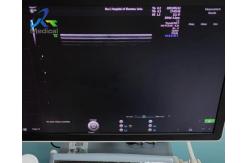 China Medical Ultrasound Machine Repair GE Voluson E8 Absence Of Bright Track Interference supplier