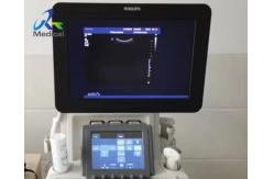 China  IU ELITE Ultrasound Machine Repair Report Error 005 Replace SPD Board supplier
