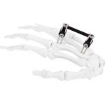 Hand Bone Pin Stent Radius Mini External Fixator Ortho Combined Type for sale