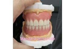 China OEM Standard Dental Lab Full Removable Dentures Easy To Take In And Out supplier