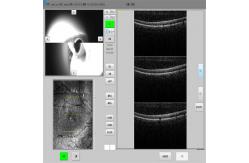 China Eye Lesions Optical Coherence Tomography System Microscopic Screening supplier