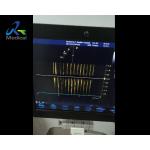 GE Vivid S6 Ultrasound Machine Repair Interference In CW Mode Replace PIB Board
