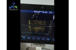 China GE Vivid S6 Ultrasound Machine Repair Interference In CW Mode Replace PIB Board supplier