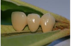 China Resin Natural Colour Composite Temporary Crown For Anterior Teeth supplier